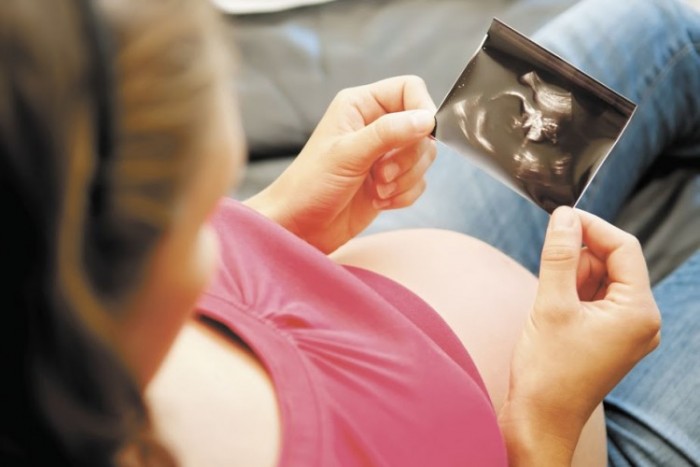 zika en Nicaragua, microcefalia, zika